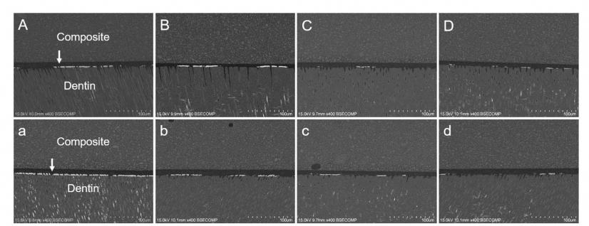 Images of nanoleakage expression from different groups. (A–D) The immediate groups. (a–d) The 10,000 times thermocycling aged groups. The first column is the Control. Groups on the right are treated with increasing concentrations of DMA. In the control group, nanoleakage deposition increased from 36.57% to 50.41% after thermoaging, while no obvious change could be detected for the DMA-treated groups.